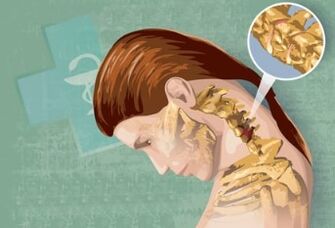 Odruchowe objawy osteochondrozy szyjki macicy