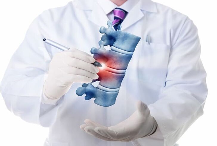 zmiany kręgosłupa spowodowane osteochondrozą klatki piersiowej